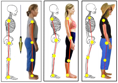 Bowen and natural posture - Bowen Training Australia